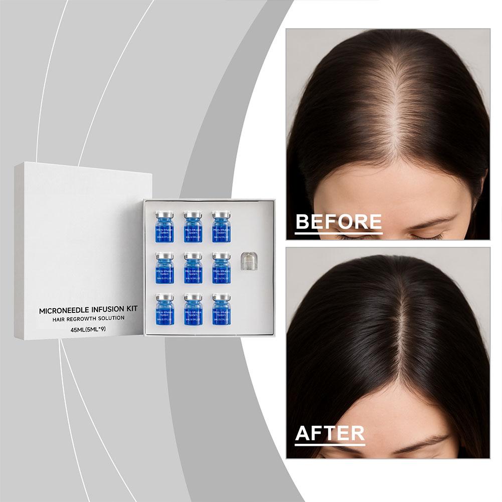 Derma Roller 0.25 - 0,25mm Haar-Essenz-Serum Mikronadel-Roller-Set Haarfollikel-Nährendes Kopfhautpflege-Set Haarverdichtungs-Conditioner