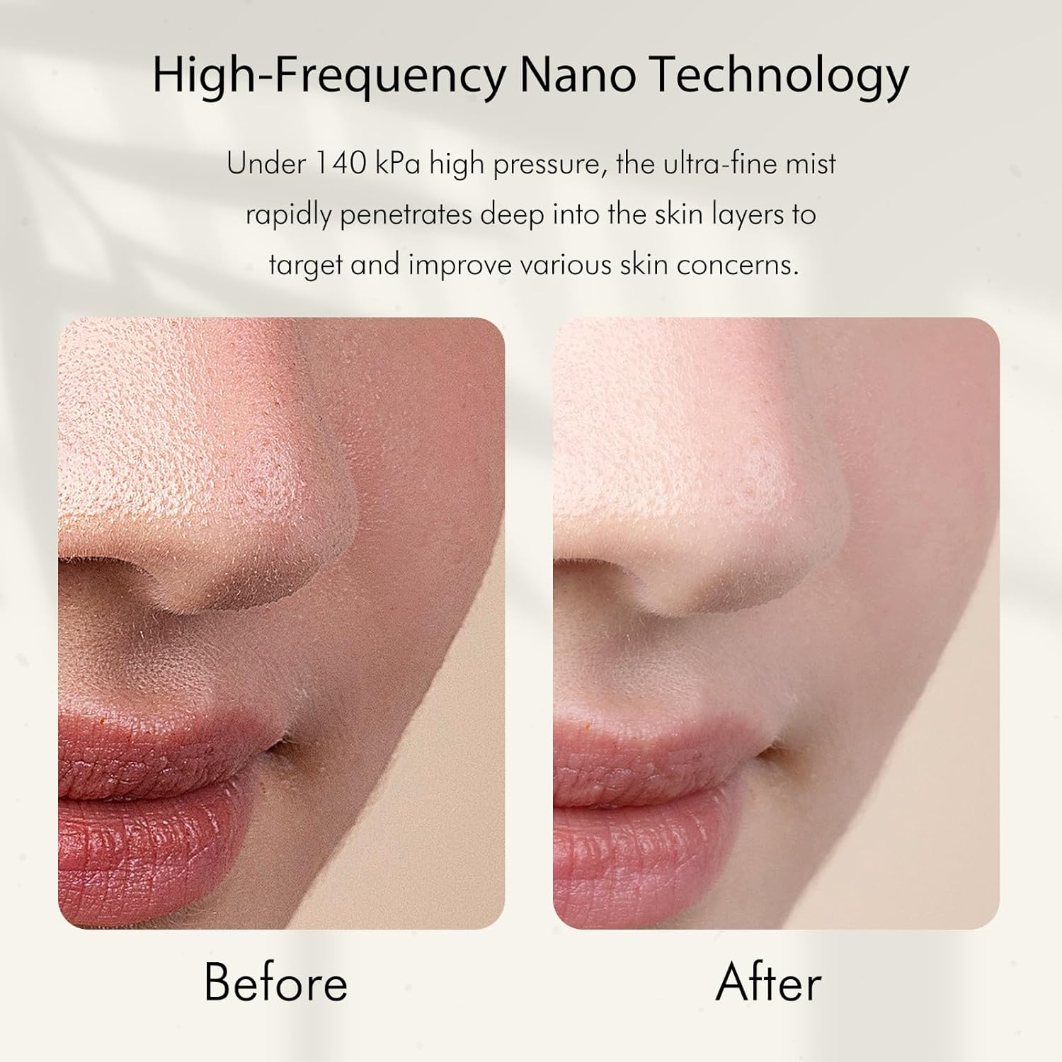 Nano-Ionischer Kaltnebel-Gesic – Facial Steamer Nano Bewertung und Preis